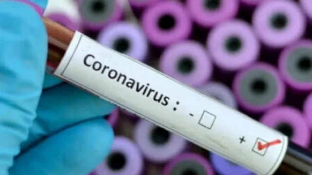 El estudio de PCR Negativo de COVID-19 será un futuro pasaporte para poder viajar: hacerlo de forma privada en Mendoza cuesta $ 3.500