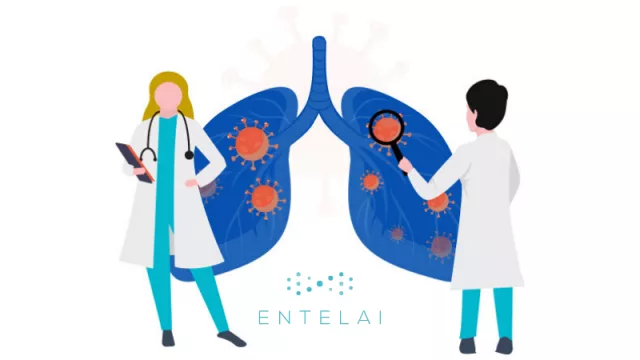 Cómo detectar Covid-19 con RX en menos de un minuto